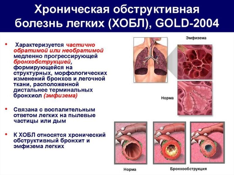 12 октября — Республиканская акция «Всемирный день спирометрии и легочного здоровья»